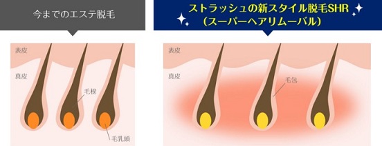 STLASSH�ɂ���